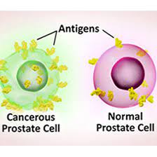 cancer vaccines and immunotherapy