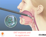 ENT Implants and its applications