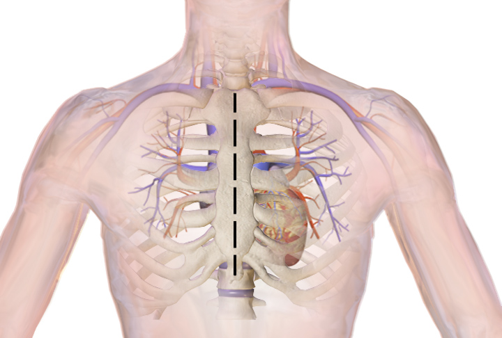 Cardiovascular diseases