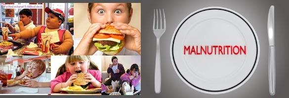 Malnutrition and Obesity