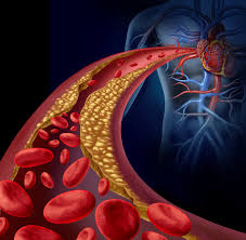 Interventional Cardiology