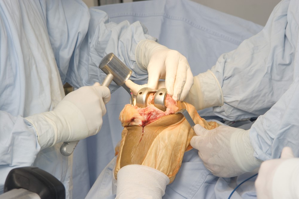 Orthopedic surgery