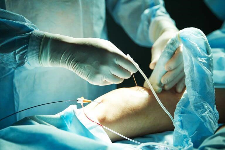 Vascular Surgery