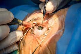 Ophthalmology