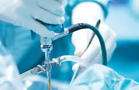 Arthroscopy